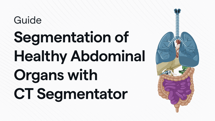 Automated Segmentation of Healthy Abdominal Organs Using CT Segmentator